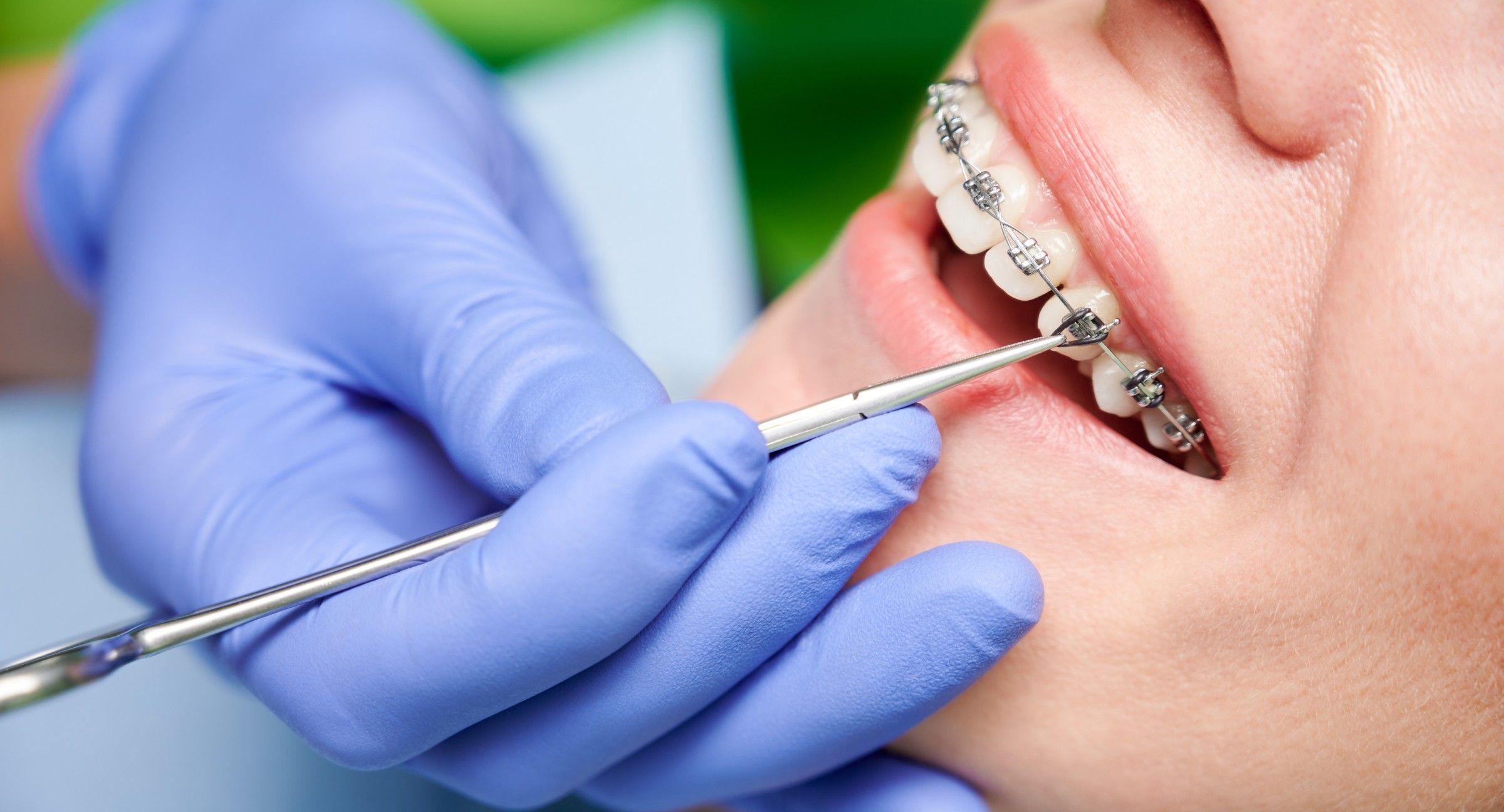 What To Expect During Your First Orthodontist Consultation