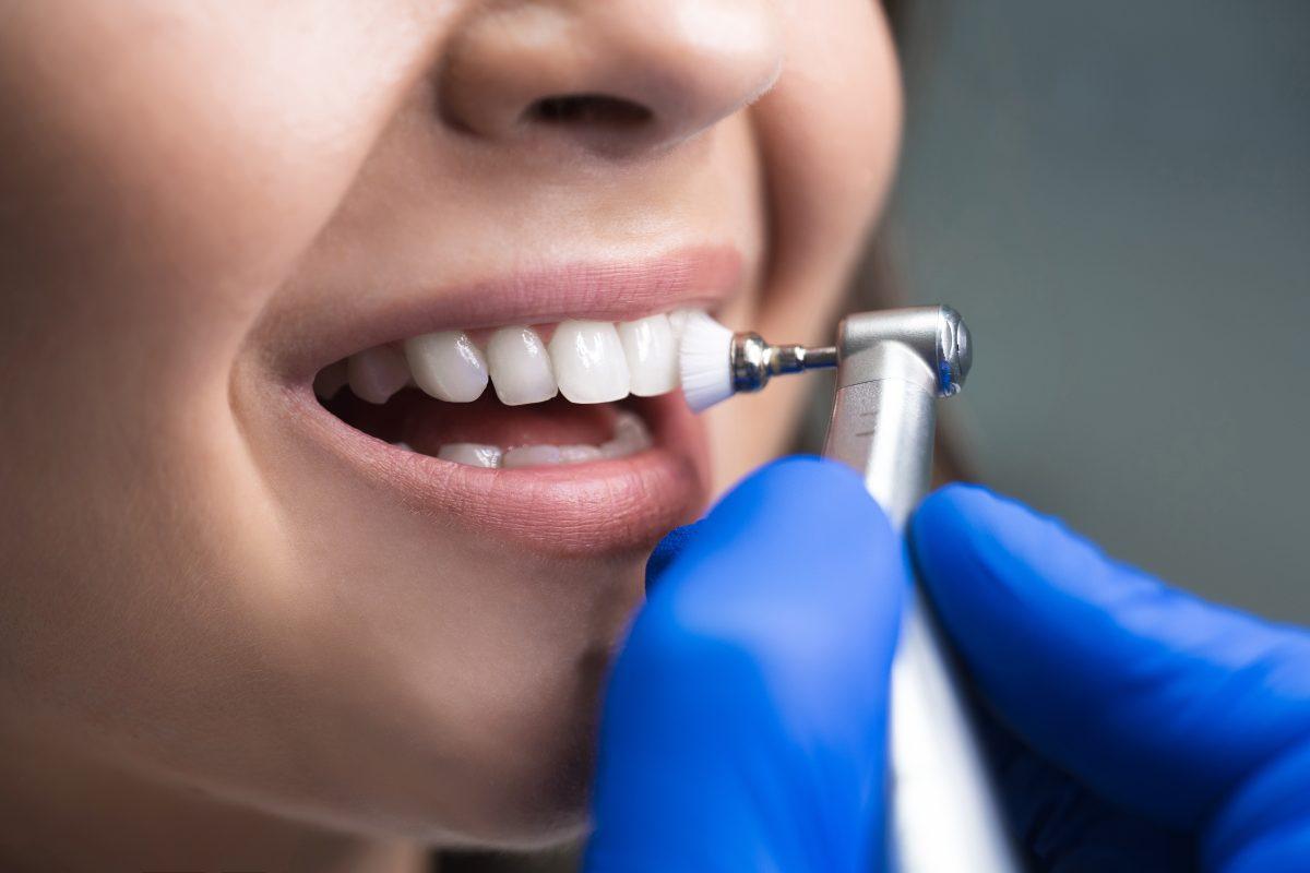 Need a Dental Cleaning Near You? Discover A Formula That Works!