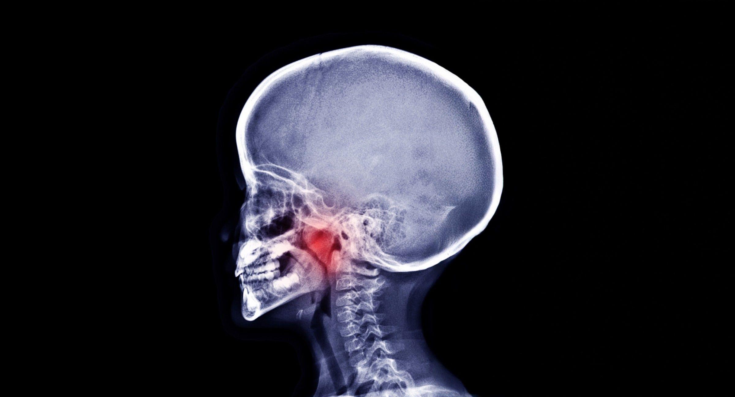 Signs Your Child Might Need Airway Orthodontics